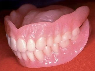 Full upper/lower denture
